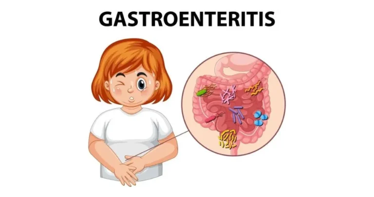 WellHealthOrganic.com: A Comprehensive Guide to Recognizing Gastroenteritis